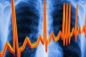 Ritmie cardiacă împotriva osteochondrozei
