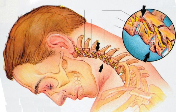 Structura vertebrelor cervicale