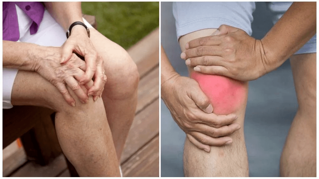 Tratamentul osteoartritei
