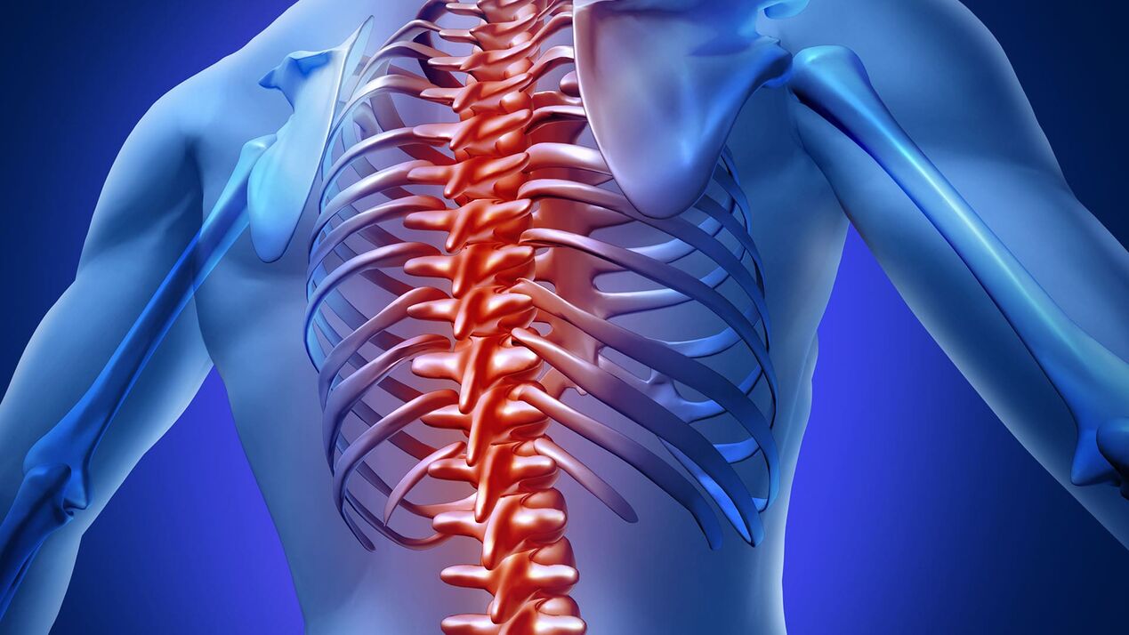 Osteochondroză toracică